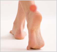 How to treat Heel Pain and Achilles Tendinitis